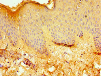ERCC2 Antibody