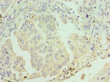 ERCC2 Antibody