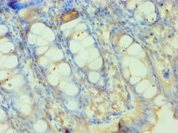 SMYD3 Antibody