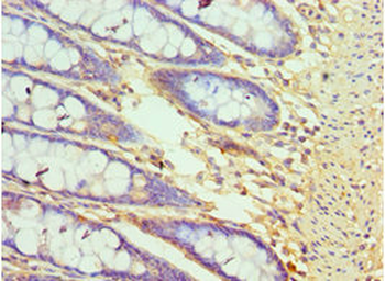 CXXC1 Antibody