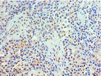 TXNRD2 Antibody