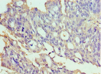TXNRD2 Antibody
