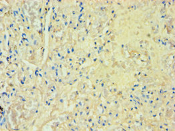 SULT1A3 Antibody