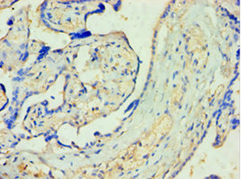SULT1A3 Antibody