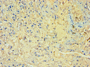 SULT1A3 Antibody