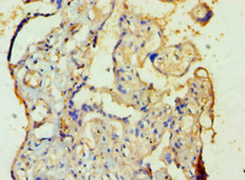 SULT1A3 Antibody