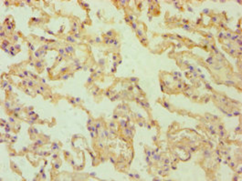 ALDH1A2 Antibody