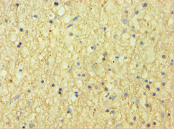 CNDP1 Antibody