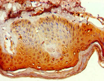 POLR1D Antibody