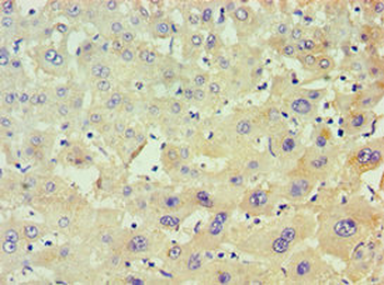 POLR1D Antibody