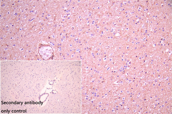 ST8SIA2 Antibody