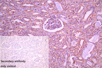 ST8SIA2 Antibody