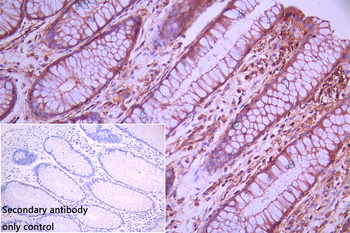 ST8SIA2 Antibody