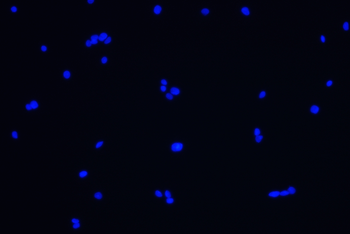 ST8SIA2 Antibody