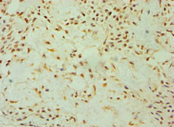 DKK4 Antibody