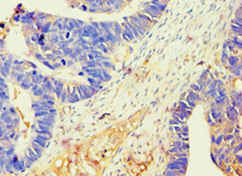 BAG2 Antibody