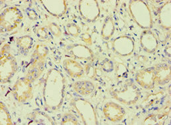 BAG2 Antibody