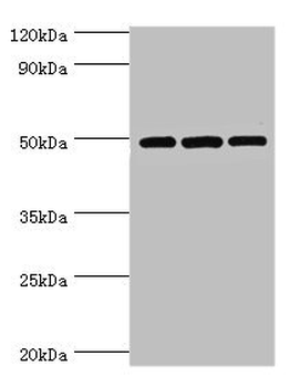 DCP2 Antibody