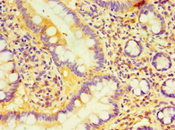 DCP2 Antibody