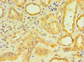 DCP2 Antibody
