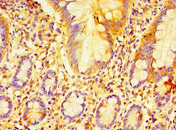ECSIT Antibody