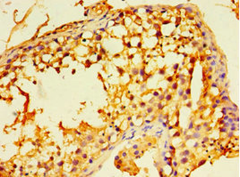 ECSIT Antibody