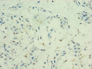 HDAC11 Antibody