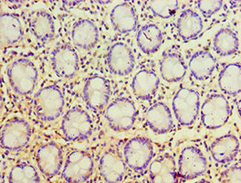 PSCA Antibody