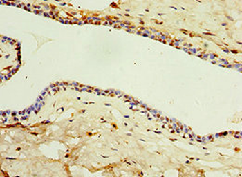 IL22RA1 Antibody