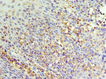 IL22RA1 Antibody