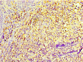 IL27RA Antibody