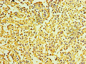 IL27RA Antibody