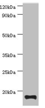 TNNC2 Antibody