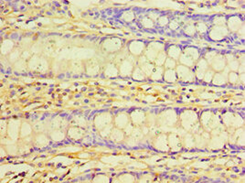 TNNC2 Antibody