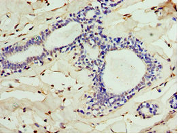 ALG1 Antibody