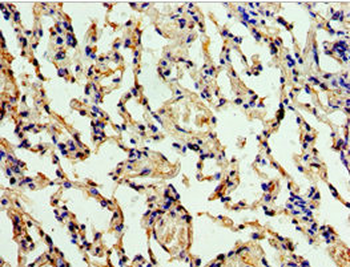 ALG1 Antibody