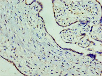 SLC25A15 Antibody