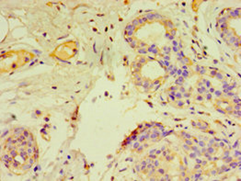 GTF2H2C Antibody
