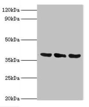 TMOD3 Antibody