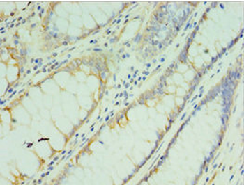 TMOD3 Antibody