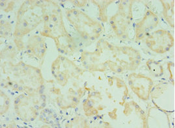 TMOD3 Antibody