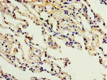 ADAM33 Antibody