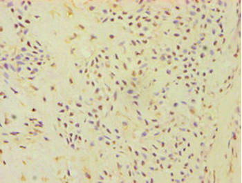 ATP5J Antibody