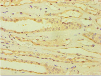 ATP5J Antibody