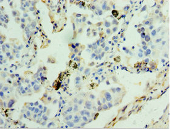 GSTA4 Antibody