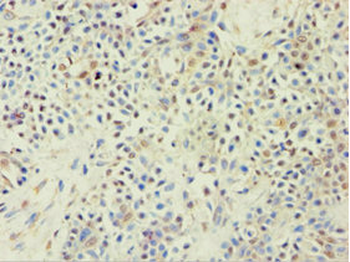 ABCF2 Antibody