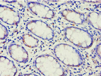ABCF2 Antibody