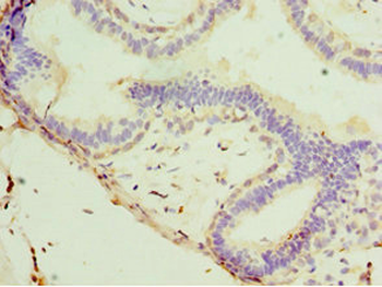 STX11 Antibody