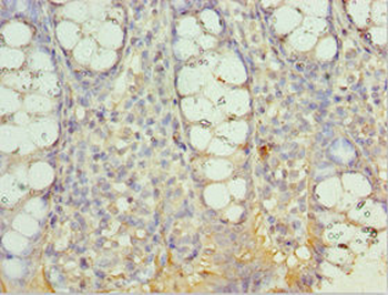 AIMP2 Antibody
