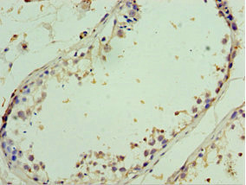 AIMP2 Antibody